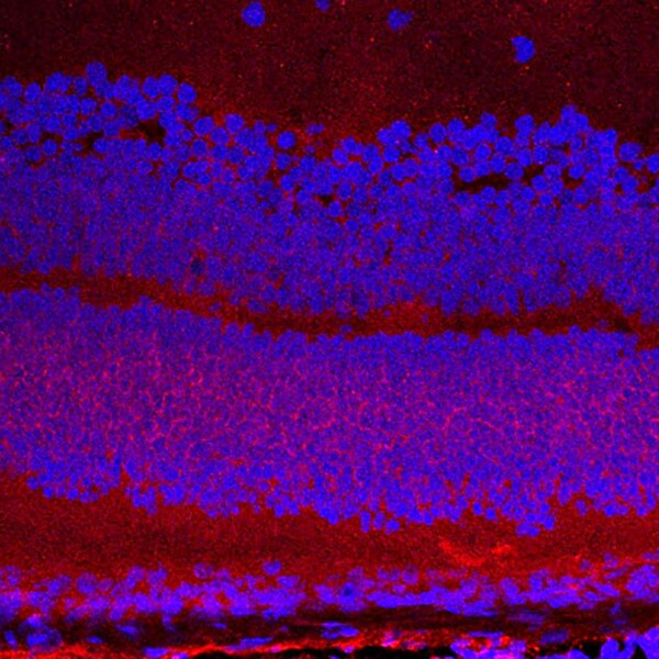 IF of P10 mouse cornea stained with DSHB antibody AFFN-IGFBP2-9D9 against IGFBP2 (red) and DAPI (blue). Image credit: Lachke Laboratory, University of Delaware.